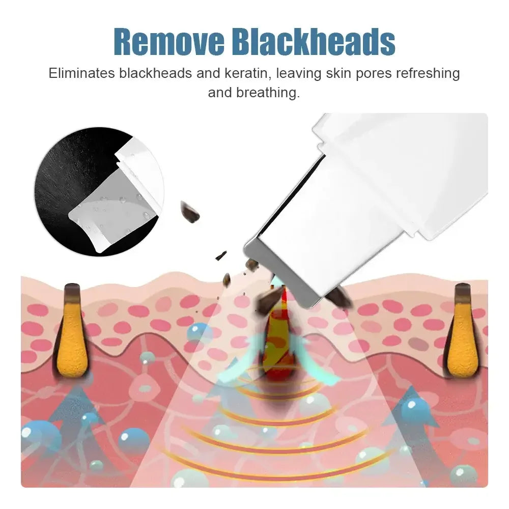 Blackhead Remover