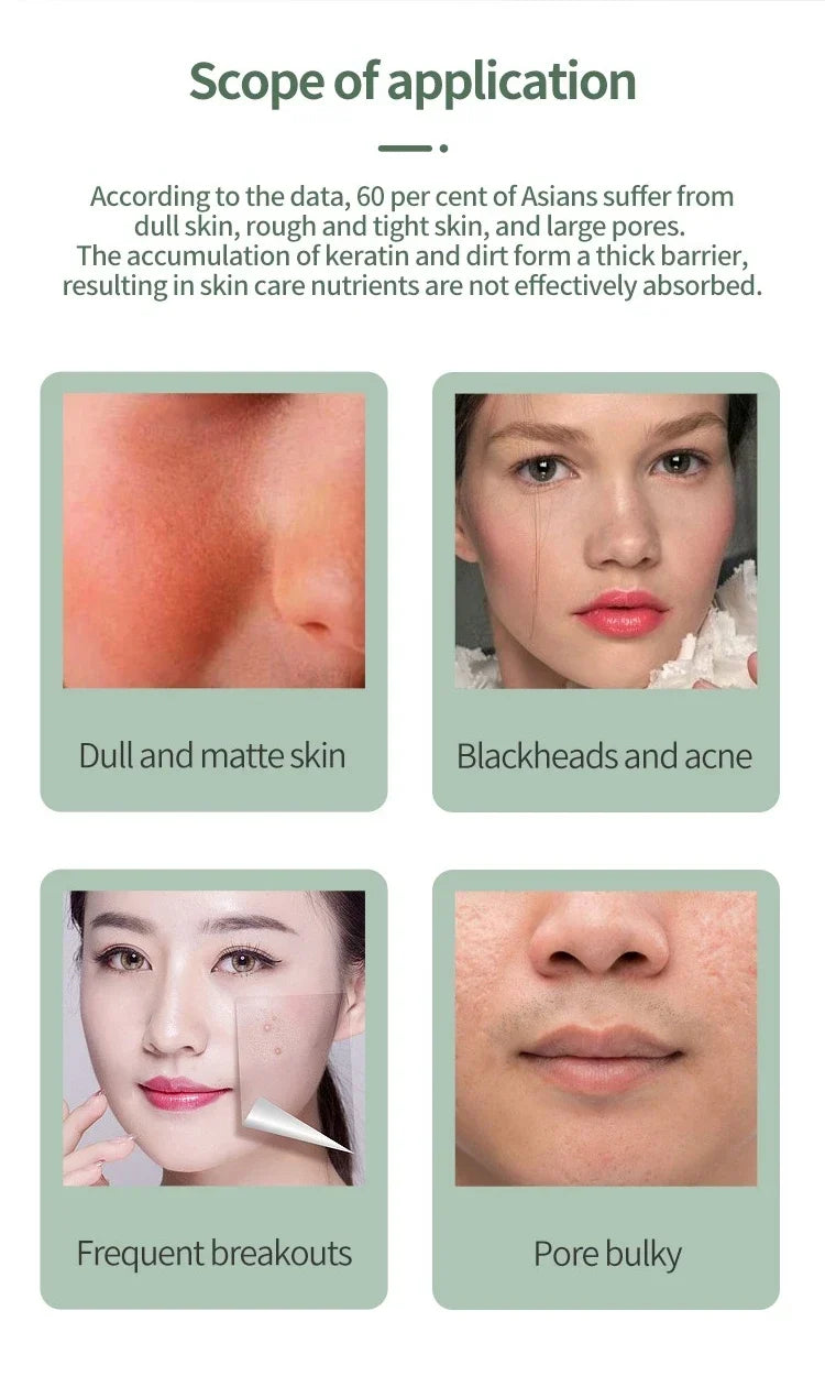 Blackhead Remover