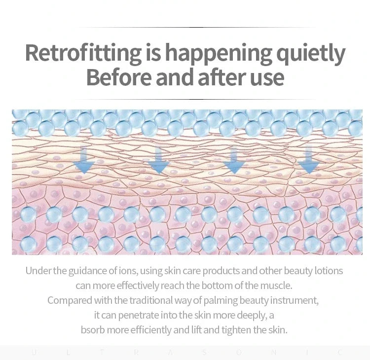Blackhead Remover
